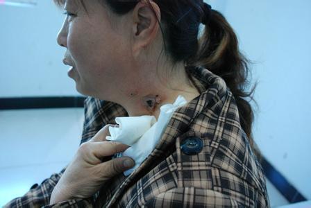 ܰͽ˵Ʒܰͽ˵ƫܰͽ洫طʳƷ