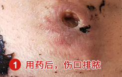 ӭѯܰͽ˵ƫ вҩ ʹ