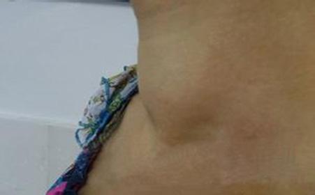 ܰͽҩƺ_?ܰͽʲôõƷ_?ҽŷܰͽ