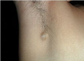 ƾܰͽ׵СƫطΡƫҩ