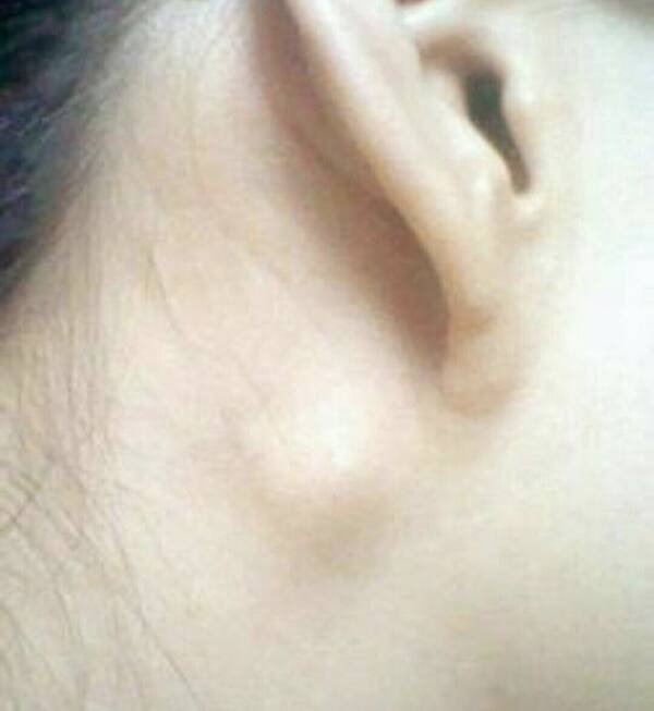 ôƳϵĤܰͽ״--洫ҩܰͽ״