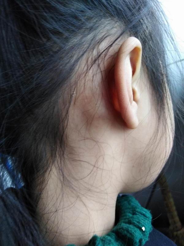 杨氏秘方治疗各种淋巴结病,各种乳腺病，甲状腺结节等类病9